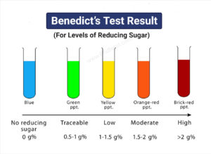 Benedict’s Test Observation /Results)