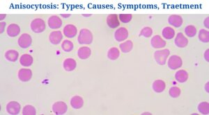 Anisocytosis: Definition, Types, Causes, Symptoms, Treatment