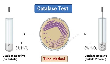 Catalase test: Principle, Procedure, Results, Precautions, Limitations Uses