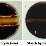 Starch Hydrolysis Test: Objective, Principle, Procedure, Results