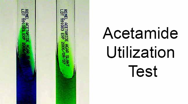 Acetamide Utilization Test: Objective, Principle, Procedure, Results, Uses, Limitations