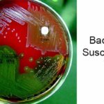 Bacitracin Susceptibility Test: Objective, Principle, Procedure, Results, Uses, Limitations