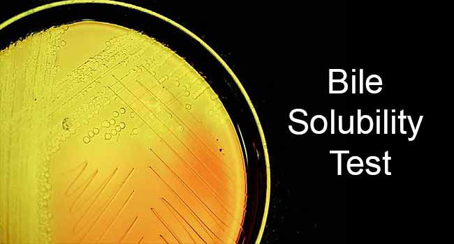 Bile Solubility Test: Objective, Principle, Procedure, Results, Uses