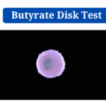 Butyrate Disk Test: Objective, Principle, Procedure, Results, Uses, Limitations  