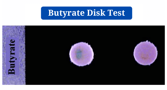 Butyrate Disk Test: Objective, Principle, Procedure, Results, Uses, Limitations  