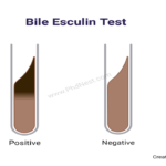 Bile Esculin Test: Objective, Principle, Procedure, Result, Uses, Limitations