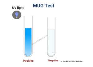 MUG Test :Objective, Principle, Procedure, Result, Uses, Limitations
