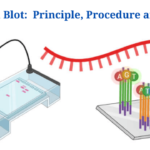 Northern Blot: Overview, Principle, Procedure and Results