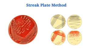 Streak Plate Method: Meaning, Principle, Methods, Importance, Limitations