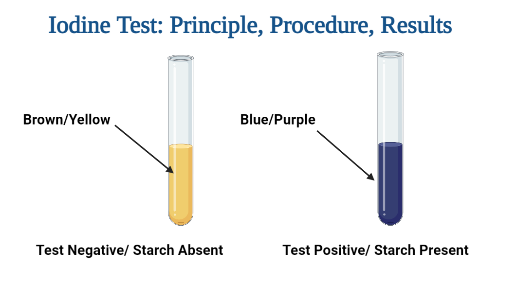 Iodine Test: Definition, Objective, Principle, Procedure, Results